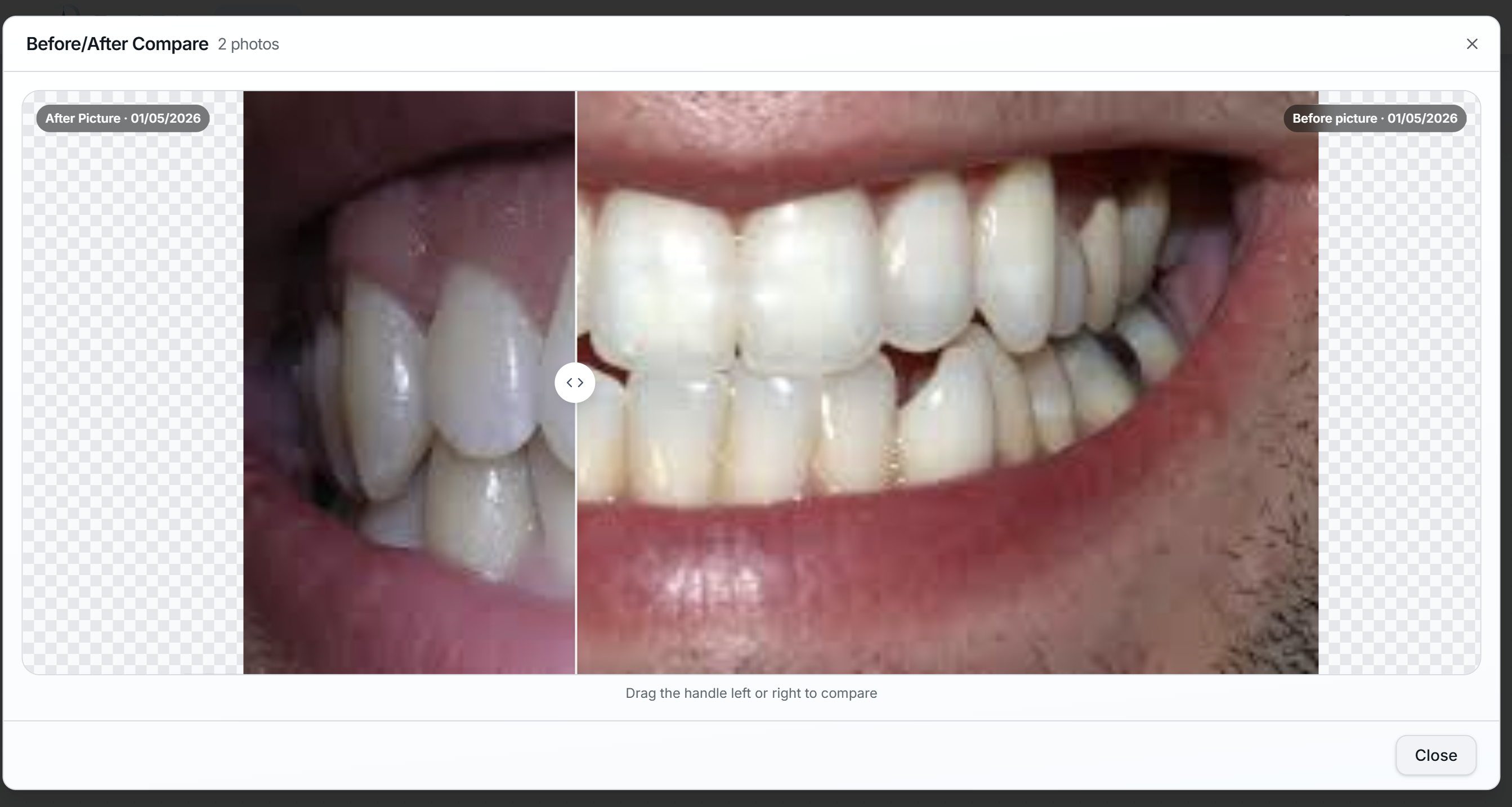 ToothTale patient documents with side-by-side photo comparison